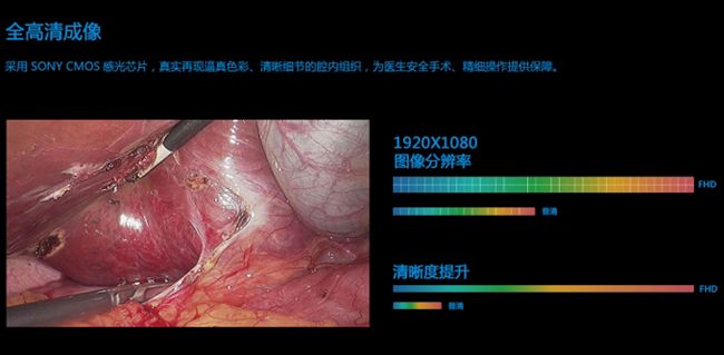 全高清成像