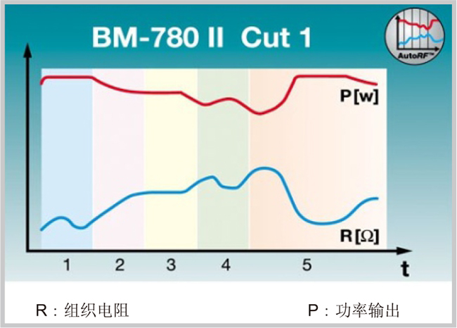 自動射頻技術