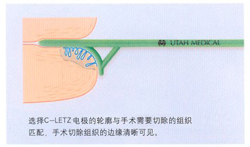 leep錐切電極